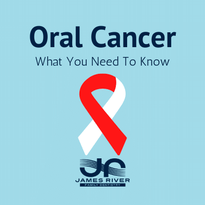 Oral Cancer JRFD