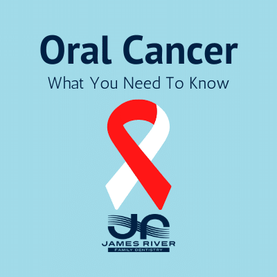 Why oral cancer is so dangerous 3 Oral cancer jrfd
