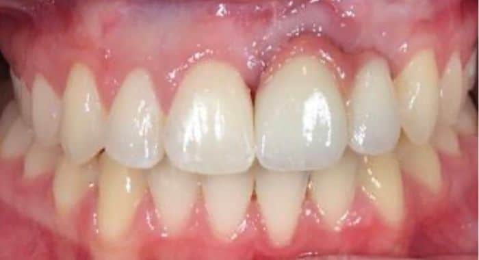 Our results 19 Complete dental reconstruction richmond