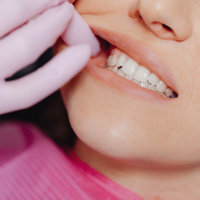 How to prevent gum disease 2 Person getting gums checked at the dentist, representing how to prevent gum disease